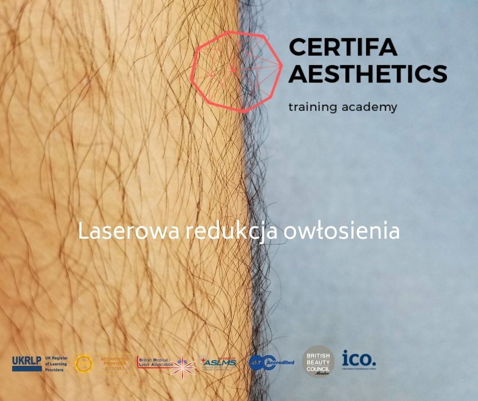 Laser czy IPL